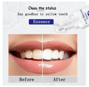 TEETH WHITENING PEN