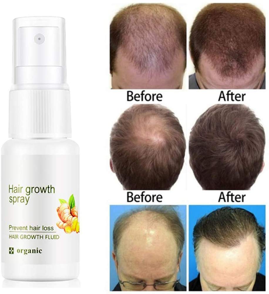 HAIR GROWTH SPRAY